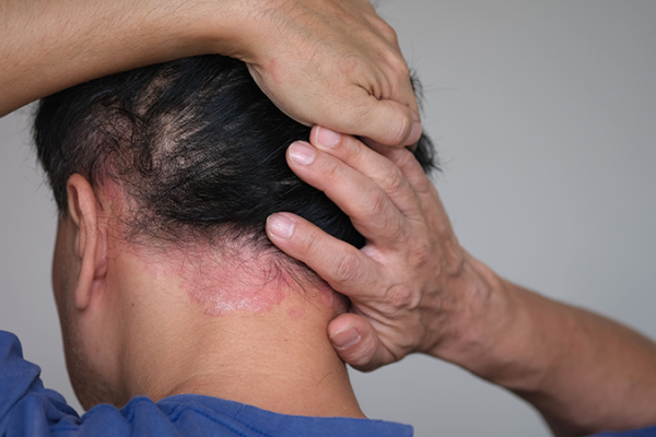 AdobeStock_1660868219